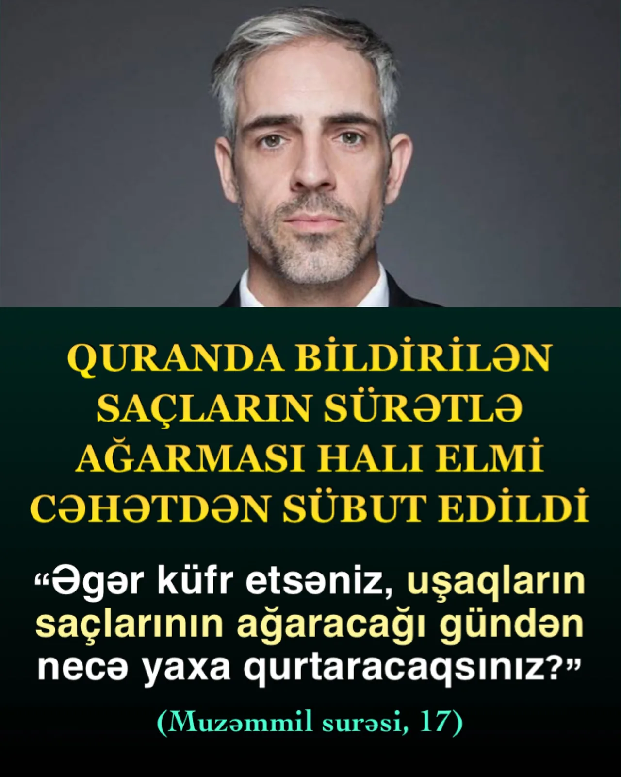 Quranda bildirilən saçların sürətlə ağarması halı elmi cəhətdən sübut edildi